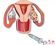 <b>大连助孕机构生殖中心：人工授精对妇女的身体</b>